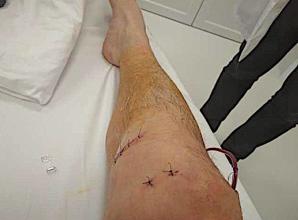 [VIDEO] TOGI BEZ SUMIEŃ: Czy w więzieniu ma umrzeć wątpliwie skazany Kamil Sękowski? Bo sędzia ze Szczecina ds. penitencjarnych Grzegorz Kołakowski jest ignorantem?