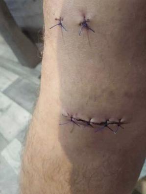 [VIDEO] TOGI BEZ SUMIEŃ: Czy w więzieniu ma umrzeć wątpliwie skazany Kamil Sękowski? Bo sędzia ze Szczecina ds. penitencjarnych Grzegorz Kołakowski jest ignorantem?