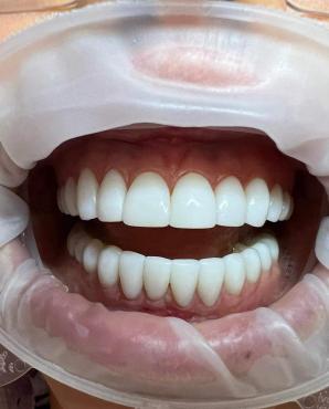 [VIDEO] Maja i Krzysztof Rutkowscy po wizycie u Dr Piotra Trafidło w Klinice Multident mogą pochwalić się Hollywodzkim uśmiechem!