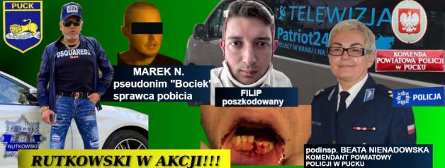 [VIDEO] Skandal! Rutkowski wskazał miejsce pobytu oprawcy Filipa. Ale dla policji w Pucku połamana szczęka, zmasakrowana twarz i zwolnienie lekarskie na 2 miesiące jest „lekkim bądź średnim uszczerbkiem na zdrowiu”, więc sprawcy nie zatrzymuje!